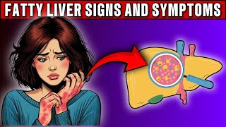 SILENT KILLER! 10 HIDDEN Signs of Fatty Liver Disease You Can NOT Ignore! - Nourish360