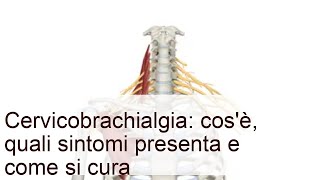 Cervicobrachialgia: cos'è, quali sintomi presenta e come si cura