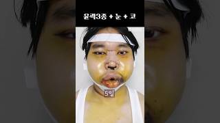 고진감래 #plasticsurgeryinkorea