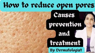 open pores சரி செய்ய creams/How to minimize/remove open pores by Dermatologist/ home remedies