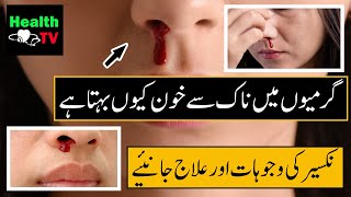 Nosebleeds in Summer | Causes and Treatment of Hemorrhages | Health TV #nose #bleed #summer