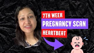 Pregnancy Week 7 Ultrasound | Baby Heartbeat Scan Procedure | My personal doctor visit experience