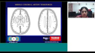 Utility of Aspects in Emergency Teleradiology by Dr Ananthalakshmi