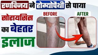 रणविजय ने होम्योपैथी के साथ पाई अपने सोरायसिस से मुक्ति | Psoriasis Testimonials