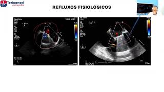 Refluxos fisiológicos