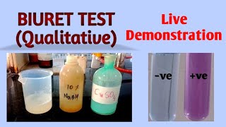 Biuret test || #Biochemistry