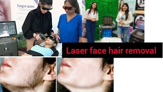 LASER FACE HAIR REMOVAL/ esa treatment pure INDIA main kahin nhi milega/ smile up clinic rohtak