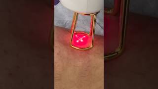 Part 3: Laser Skin Dance #skincare