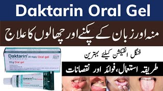 Daktarin oral gel uses in urdu | daktarin oral gel how to use | side effects | daktarin oral gel |