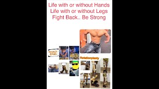 Life with or without hand and leg: Fight back and Never give up and Be strong