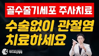 골수줄기세포 주사치료로 수술없이 관절염 치료하세요~!!