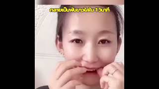 ซ่อนฟันที่หักและหักได้อย่างสมบูรณ์แบบ! ให้รอยยิ้มที่สดใส