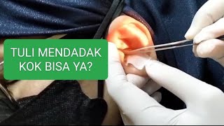 TELINGA MENDENGUNG, TULI MENDADAK (SUDDEN DEAFNESS)