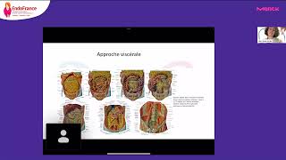 Replay - Webinaire Endométriose n°2 - Douleur - Partie 3