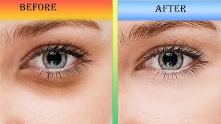 👀How To Remove Dark Circle Under Eyes From A Photo || 😊Professional Skin Retouching In Photoshop