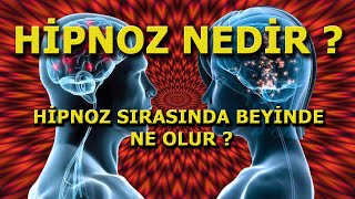 HİPNOZ NEDİR ? HİPNOZ SIRASINDA BEYİNDE NE OLUR ?