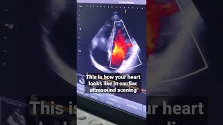 Cardiac Ultrasound Scan #healthcaretechnology #usg #cardiac #biomedicalengineering #health #doctor