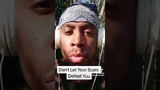 Don't Let Your Scars Defeat You!!!! #spacekiddthehitmaker #acnescars#fyp