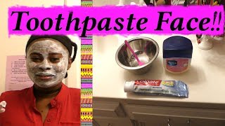 I Applied Toothpaste & Vaseline On my face, see what happened, Toothpaste beauty for Acne