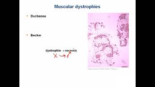 Biochemistry Genetic Autosomal recessive diseases