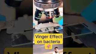 #microscope #science #microscopics #biology #microscopy vinegar effect on bacteria #dmlt #labtech