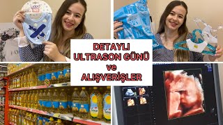 550₺’LİK MİGROS ve TRENDYOL ALIŞVERİŞİ | DETAYLI ULTRASON GÜNÜMÜZ #günlükvlog #alışveriş