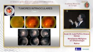 Neoplasias Malignas en Oftalmología, Retina, Acad. Dr. Luis Porfirio Orozco Gómez - 26/09/2014