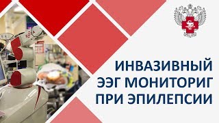 Методика роботассистированного инвазивного ЭЭГ мониторинга при эпилепсии