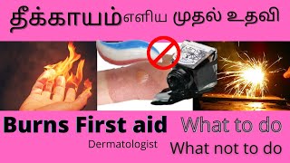 Burns first-aid/cracker burns/ scalds/ தீக்காயம் ஏற்பட்டால் என்ன செய்ய வேண்டும்?