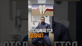 ОТСЛАИВАЕТСЯ ДЕСНА? РЕЦЕССИЯ ДЕСНЫ?