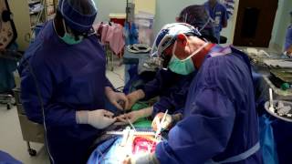 Minimally Invasive Video Assisted Heart Surgery - Alexander R. Marmureanu MD