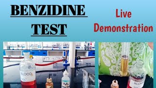 Benzidine test || Blood in urine || Hematuria || #Biochemistry