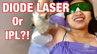 DIODE LASER HAIR REMOVAL BY SKINSTATION | HONEST REVIEW  |ANO MAS BETTER,IPL OR DIODE? | kim stories