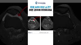 무릎 MRI 이상소견? 이런 경우에 주의하세요! #무릎관절염 #MRI #shorts