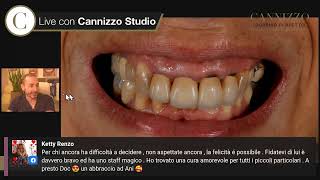 Impianti fissi dentali