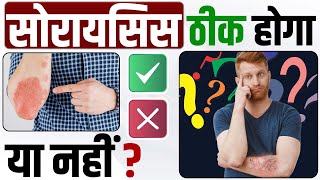 क्या सोरायसिस बिल्कुल ठीक हो सकता है? | Will psoriasis patients be cured or not | psoriasis cure