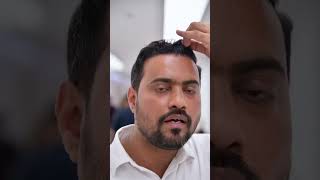 Hair transplant result #hairtransplant #hair #hairstyle #hairclinic #hairloss