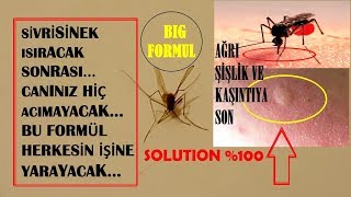 Formülü Buldum Sivrisinek Acı Şişlik ve Kaşıntısına Son