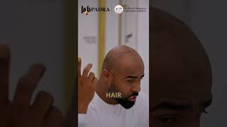 رأي وحشي من الامارات في بادرا #hair #before #hairtransplant #beforeandafter #explore #padra