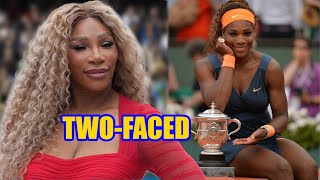 SERENA WILLIAMS ACCUSED OF DOING THE UNTHINKABLE TO HER FACE AND SKIN