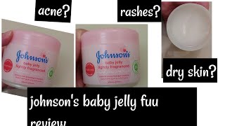 johnson's baby jelly ||VASELINE ||ACNE SKIN||Dry skin||oily skin