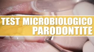 Test microbiologico per la parodontite | PARODONTITE