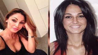 Oggi è così, ma ricordate Anna Tatangelo prima dei ritocchini La differenza è più che notevole