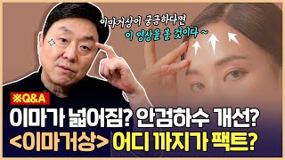 이마거상하면 이마가 넓어진다...? 쌍꺼풀이 풀린다...? 이마거상술의 진실 알려드릴게요 - 의학박사 백승준