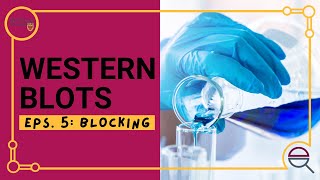 Western Blot: Introduction to Blocking