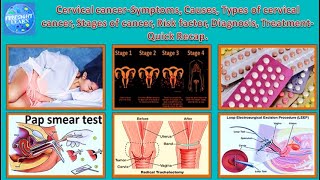 Cervical Cancer Symptoms, Causes,Types ,Stages of cancer,Risk factor,Diagnosis,Treatment Quick recap