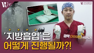 연휴동안 먹은거 다 빼준다! 지방흡입 실험 : 탱탱한 곤약 다이어트 시키기