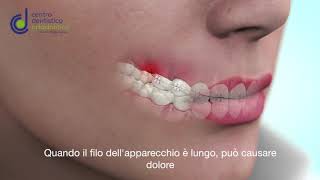 TUTORIAL TAGLIARE FILO APPARECCHIO FISSO