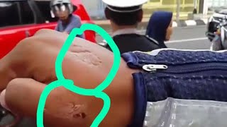 Emak-emak preman pasar tidak terima di tilang, gigit tangan polisi