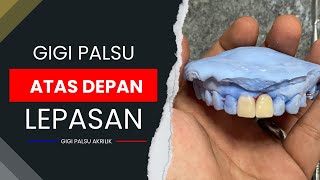 Cara Membuat 2 Gigi Palsu Depan Atas, Begini Cara Nya